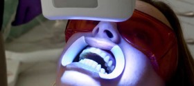 Teeth Whitening By A Wilmette Dentist